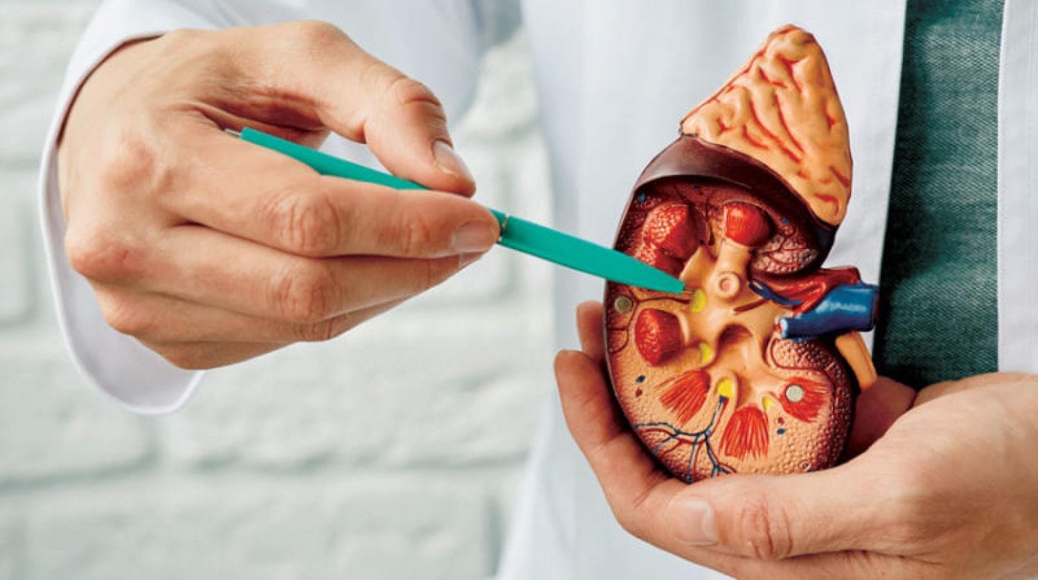 حصوات الكلى: الأسباب والأعراض وطرق العلاج الدوائي وأحدث التقنيات العلاجية في مستشفى عبيد التخصصي