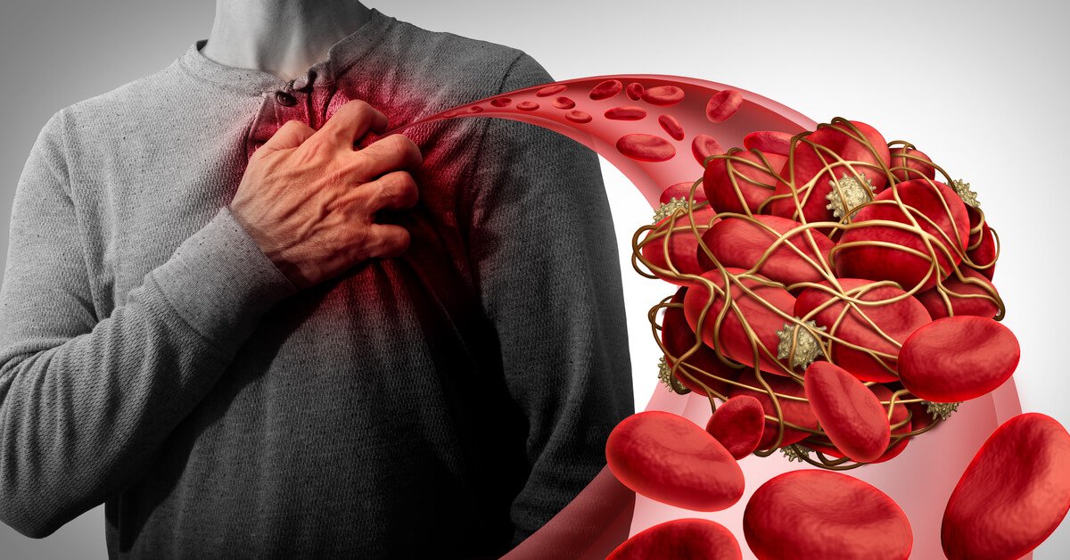 أفضل تقنيات توسيع الشرايين بالدعامات في مستشفى عبيد التخصصي بالرياض والأحساء: رعاية متقدمة لحماية القلب والأوعية الدموية