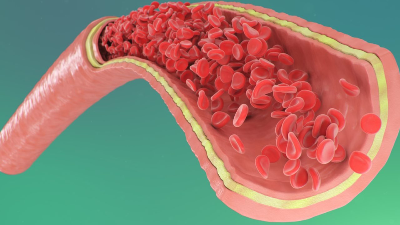 كيف يمنع التشخيص المبكر مضاعفات خطيرة في أمراض الشرايين في مستشفى عبيد التخصصي بالرياض والأحساء