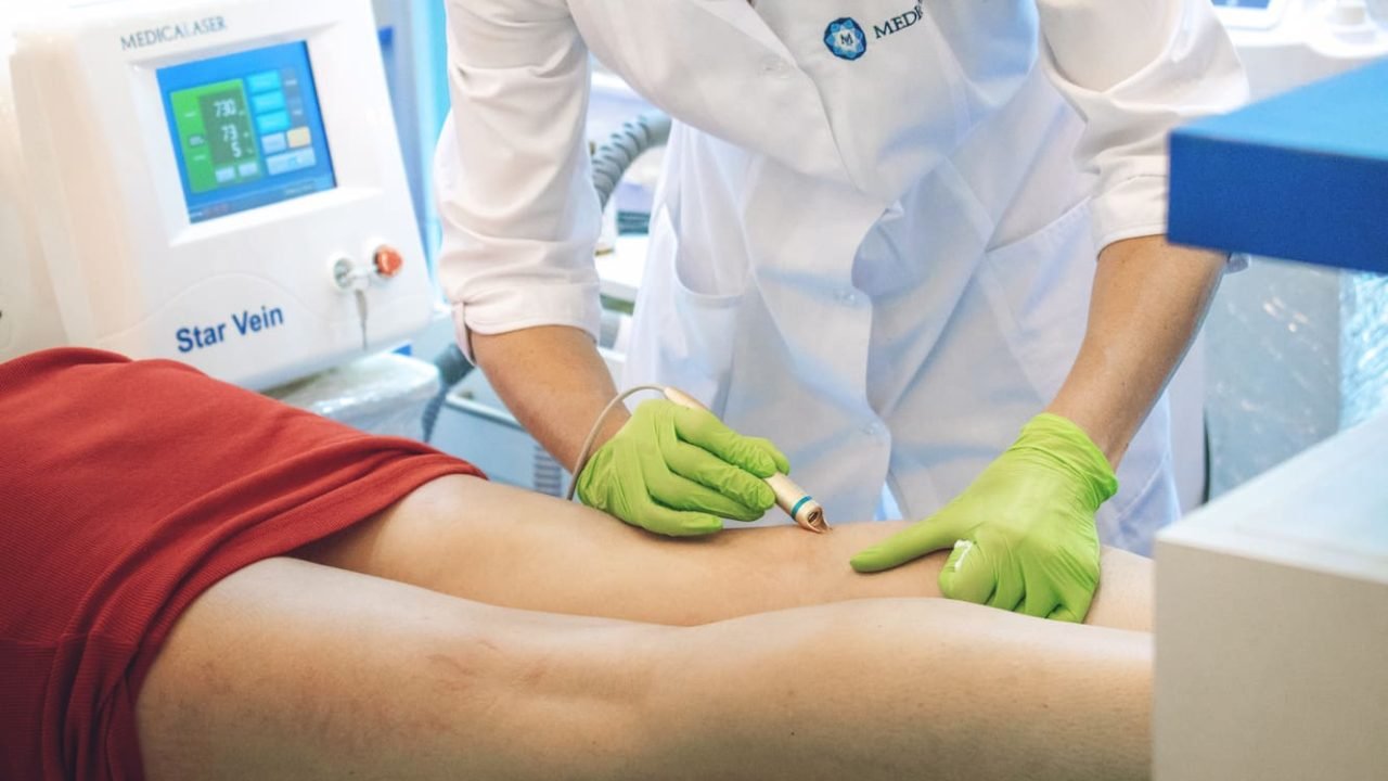 التقنيات بالليزر لعلاج الأوردة المتوسعة في مستشفى عبيد التخصصي بالرياض والأحساء